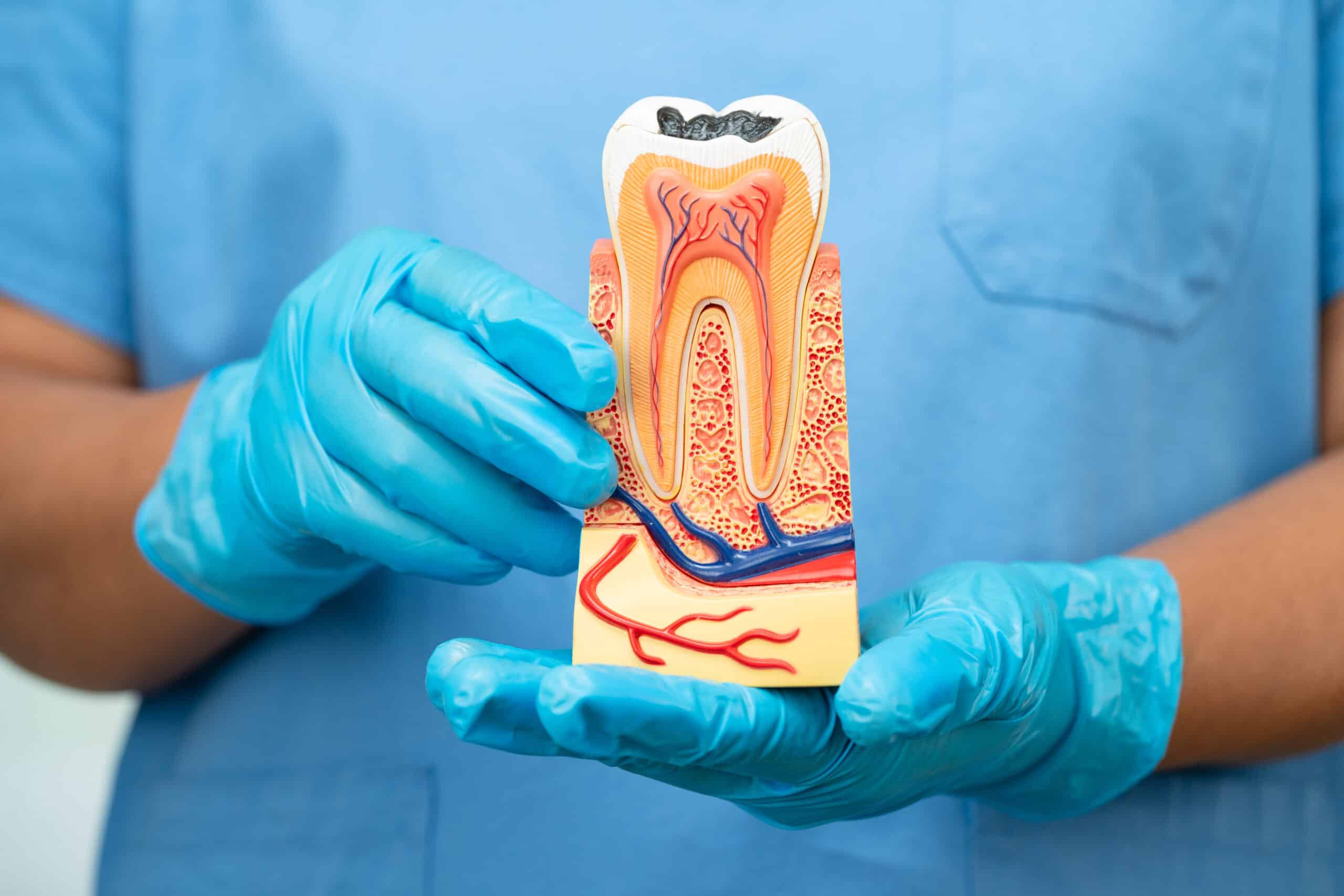 We use advanced technology to perform root canal treatments that relieve pain, save natural teeth, and promote lasting oral health — all while ensuring your comfort.